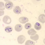babesia microti