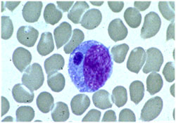 echaffeensissmear E. chaffeensis smear